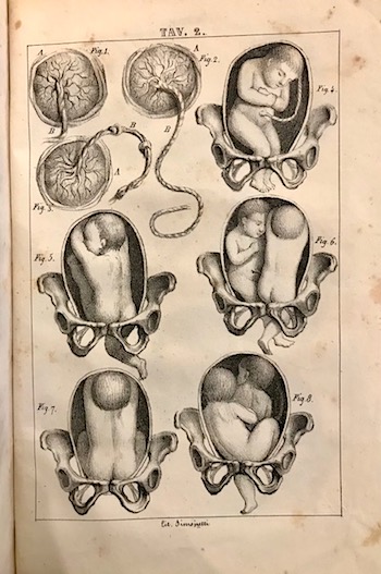 Rocco Del Giudice Guida pratica per assistere le donne gravide, le parturienti, le puerpere e i bambini necessaria ai giovani chirurgi, alle levatrici ed utilissima alle madri di famiglia 1845 Napoli presso Giuseppe Cristarelli